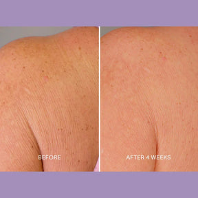Magec Collagen Fullerene Neck Cream - Tightening & Anti-Wrinkle Formula