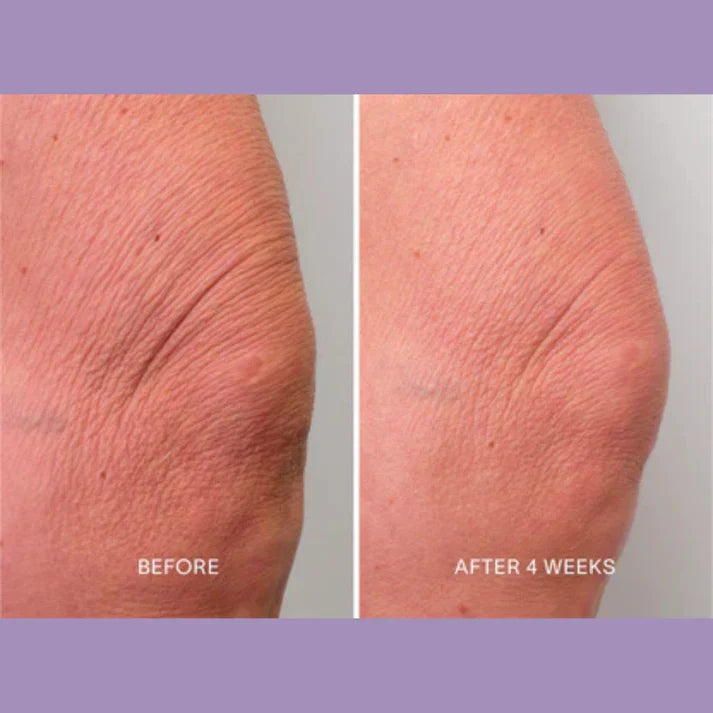 Magec Collagen Fullerene Neck Cream - Tightening & Anti-Wrinkle Formula